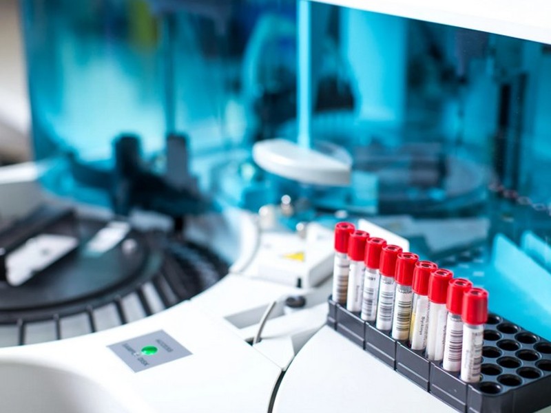 Medicinski laboratorijski paketi uključuju skup različitih pretraga